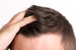 How to Find Hospitals That Offer Hair Transplants: Tips & Advice
